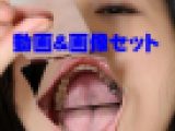 明日奈さんの歯　★★動画＆特典画像★★